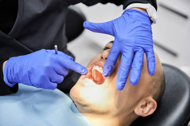 Best Emergency Dental Extractions in River Ridge, LA